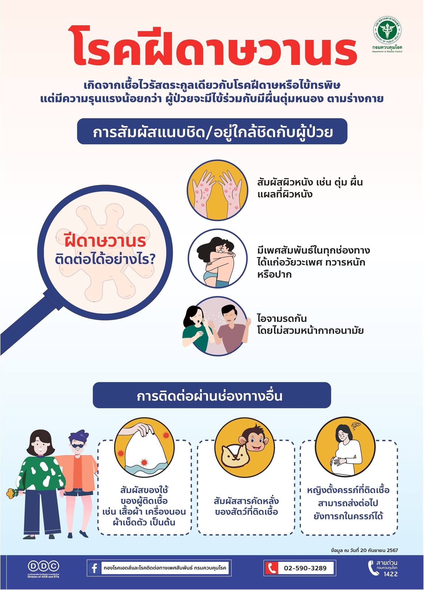 ประชาสัมพันธ์การป้องกันโรคฝีดาษวานร